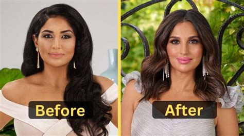 leva bonaparte plastic surgery|Cosmetic Procedures the Real Housewives Got in 2021